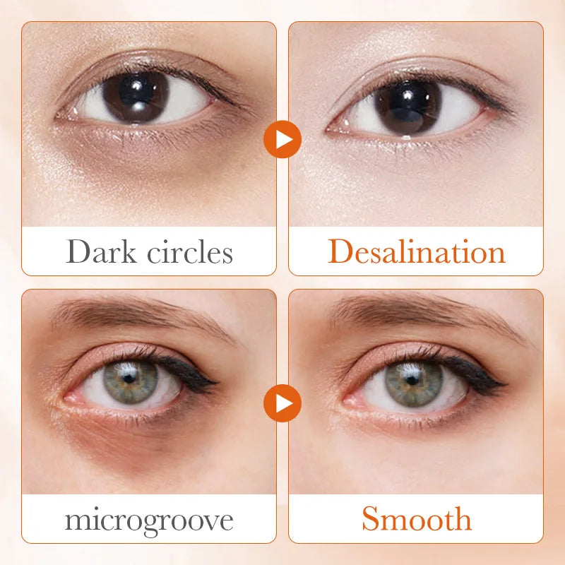 SADOER Vitamin C Eye Cream – Anti-Dark Circles, Puffiness Reduction, Moisturizing & Brightening Eye Care